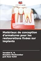 Matériaux de conception d'armatures pour les restaurations fixées sur implants (French Edition) 6208881145 Book Cover