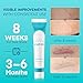 Aroamas Scar Advanced Scar Gel - Medical-Grade Silicone Scar Gel to Help Improve The Appearance of Scars and Stretch Marks for Face & Body - 45g