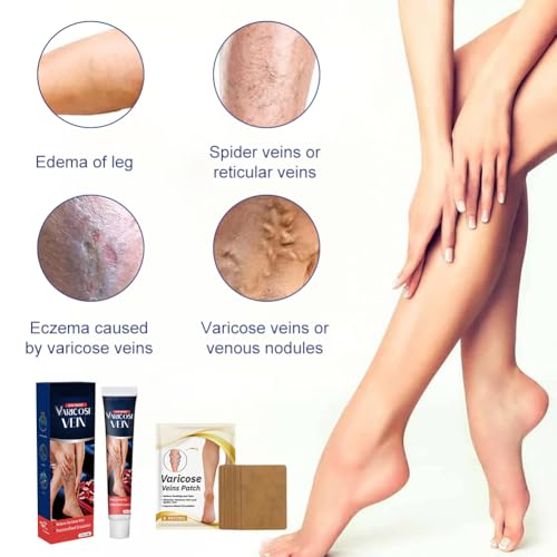 Krampfadern Creme, Krampfadern Salbe, Varicose Veins Cream, Stärkung der Kapillargesundheit, Verbesserung der Durchblutung