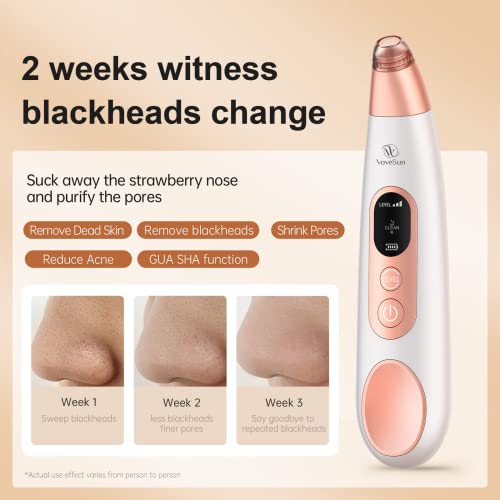 2022 Newest Blackhead Whitehead Pore Vacuum Cleaner Remover-Electric Facial Blackhead Suction Devices,Usb Rechargeable Acne Comedone Extractor Tool Kit With 5 Probes & 3 Adjustable Suction Level #TOP2
