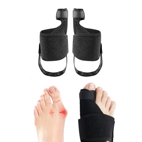 SSKHE Paquete de 2 férulas correctoras Hallux Valgus, vendaje corrector, corrector de juanetes, para hombres y mujeres, protección del dedo gordo del pie