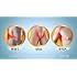 Itch Guard for Itching & Rashes 25gm (Pack of 4) - Pamherbal