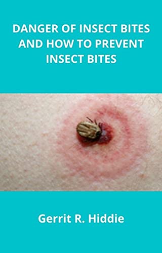 THE DANGERS OF INSECT BITES AND ITS PREVENTION