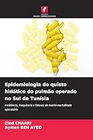 Epidemiologia do quisto hidático do pulmão operado no Sul da Tunísia (Portuguese Edition) 6209626238 Book Cover