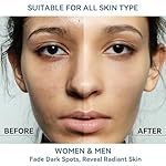 Dark Spot Remover for Face and Body, Dark Spot Corrector Serum, Melasma Treatment for face, Age Spot & Freckles Remover, Skin Care Serum for Uneven Skin Tone with 360° Roller Massage Ball, 0.67 fl. oz - Image 4
