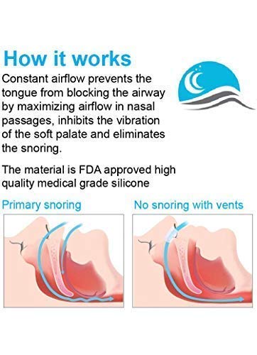 Snore Bastion Snoring Solution - 12 Anti Snoring Nose Vents - Anti Snoring Devices - Nasal Dilators to Stop Snorring - Snore Stopper Set - Snoring Aid (Black)