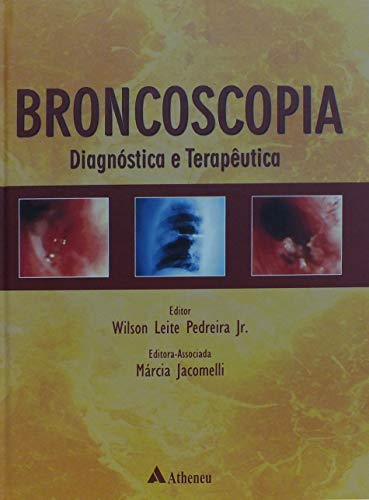 Broncoscopia: Diagnóstica e Terapêutica