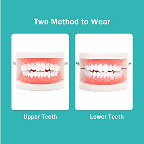 Image of Mouth Guard During Sleep, Soft Reusable Mouth Cushion for Adults Comfort Fit Night Guard Portable Lightweight Design for Daily and Travel Use (30 Pack)