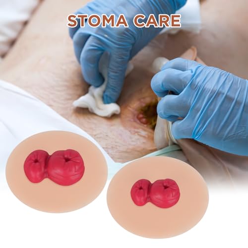 Image of Sticky Loop Ileostomy Simulators, Double-Barrel Stoma Training Model Set, Multi-Skin Tone Ostomy Care Practice Models for Medical Training and Patient Education - Light