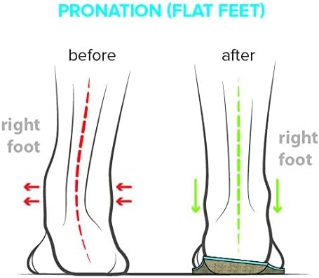 Arches Insoles Type 1 - Pronation/Flat Feet, Men's Size 11-11.5 / Women's Size 13-13.5 - Image 4
