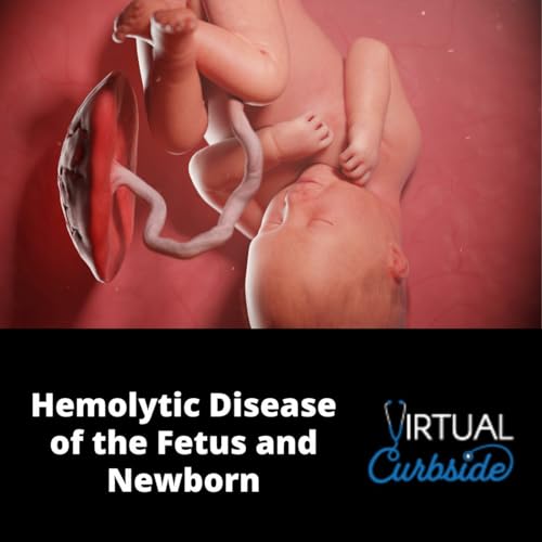 Episode 362: #84-3 Hemolytic Disease of the Fetus and Newborn: Management Podcast Por  arte de portada