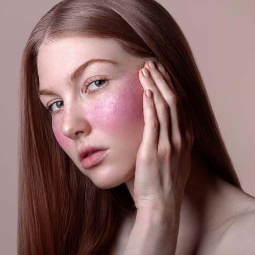 SLP 529: Self Love Quicky - Natural Remedies for Rosacea