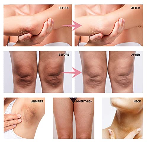 Private Parts Whitening Cream, Dark Spot Corrector Cream, Joint Whitening Cream, Moisturizing Body Lotion - Image 3