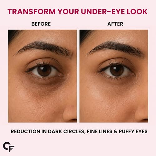 Image of Carbamide Forte Hydrogel Under Eye Patches For Dark Circles | Under Eye Mask with Caffeine, Rose Extract, Niacinamide | Reduces Dark Circles & Puffiness | Hydrating & Brightening Eye Patches | 60 Patches (30 Pairs)
