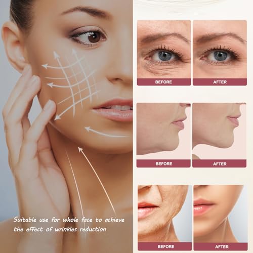 Tonsprer FAQ101 Mzong Radio Frequency Skin Care Device thumb #1