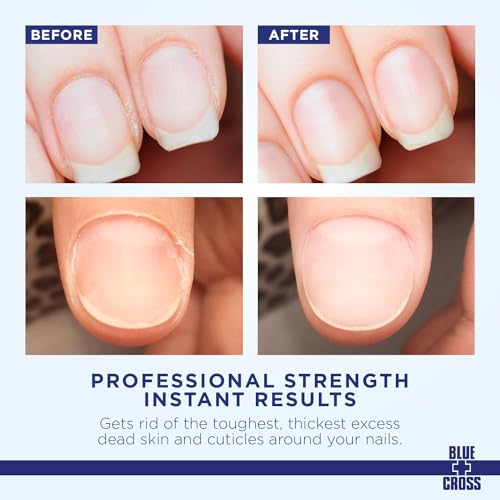 Blue Cross 202 Professional Nail Care, Hydrating, Moisturizing, Strengthening Cuticle Remover + Softener Cream thumb #1