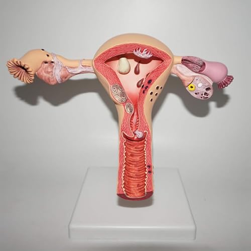 Modèle utérus et ovarien de taille réelle AMITD pour éducation médicale - 3