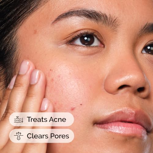 The Ordinary Salicylic Acid 2% Solution, Acne-Fighting Serum for Blemish-Prone Skin, 30ml