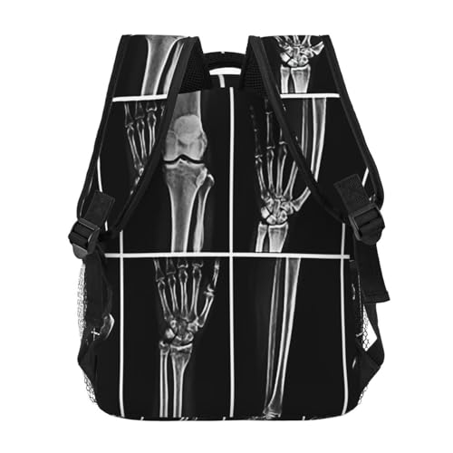 X Ray Skull Radiology Backpack for Men Women, Travel Laptop Backpack Computer Bag Daypack for Business Work Weekender4