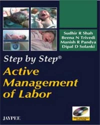 Active Management of Labor (Step by Step)