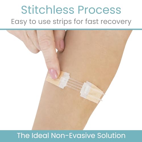 Image of ViveCare Emergency Laceration Closures (4 PCS) - Close Wounds Without | Stitches - Butterfly Bandages Wound Closure Kit with Sterile Strips, Island Dressings, Alcohol Wipes & Swabs