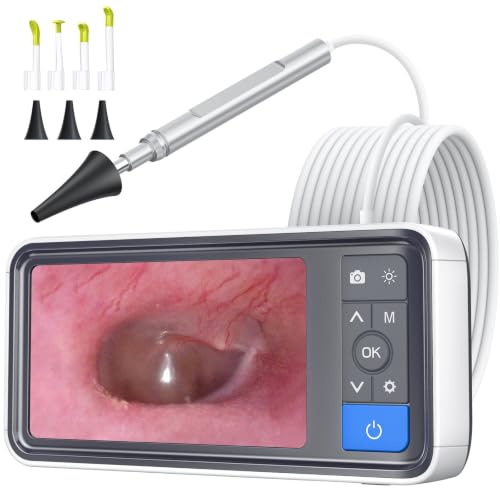 ScopeAround Otoscope with IPS Screen