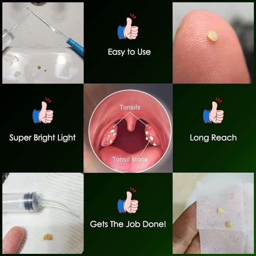 Airgoesin™ Lighted Tonsil Stone Remover Tools or Earwax Removal Tools, Yellow, 3 Tips, Tonsillolith Pick Case + 1 Irrigator Cleaner : Yellow