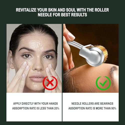 Image of Professional Gold Plated 192 Needles Titanium Alloy Derma Roller, Gold, 0.5mm