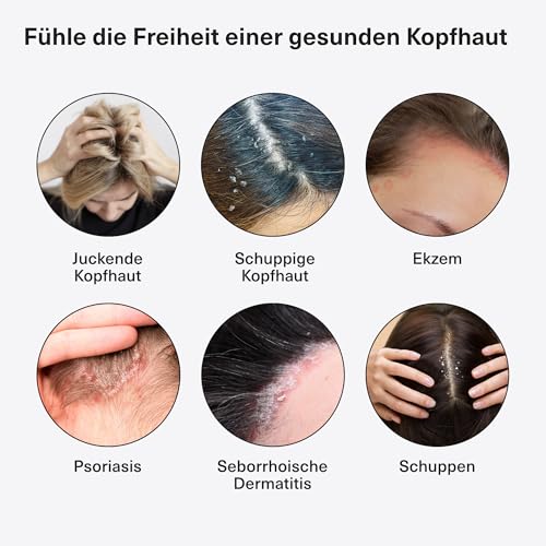 Healpsorin Shampoo - Pflegendes Kopfhautshampoo für schuppige, empfindliche & trockene Kopfhaut - Mit Salicylsäure, Urea & DERMOSOFT® DECALACT - Steroidfrei - 500ml