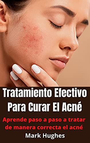 Tratamiento Efectivo Para Curar El Acné: Aprende paso a paso a tratar de manera correcta el acné