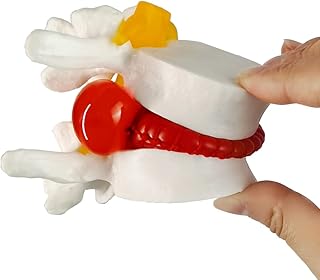 2023 New Human Anatomical Lumbar Herniation Model, Vertebrae Degenerative Lumbar Human Spine Model 1PCS,Lumbar Spine Model for Teaching & Learning - Excellent Way for Demonstrating Disc