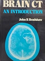 Brain Ct: An Introduction 0723608555 Book Cover
