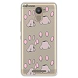 ❤ Diseño: 【 Transparente 】que deja ver el color original de su teléfono
