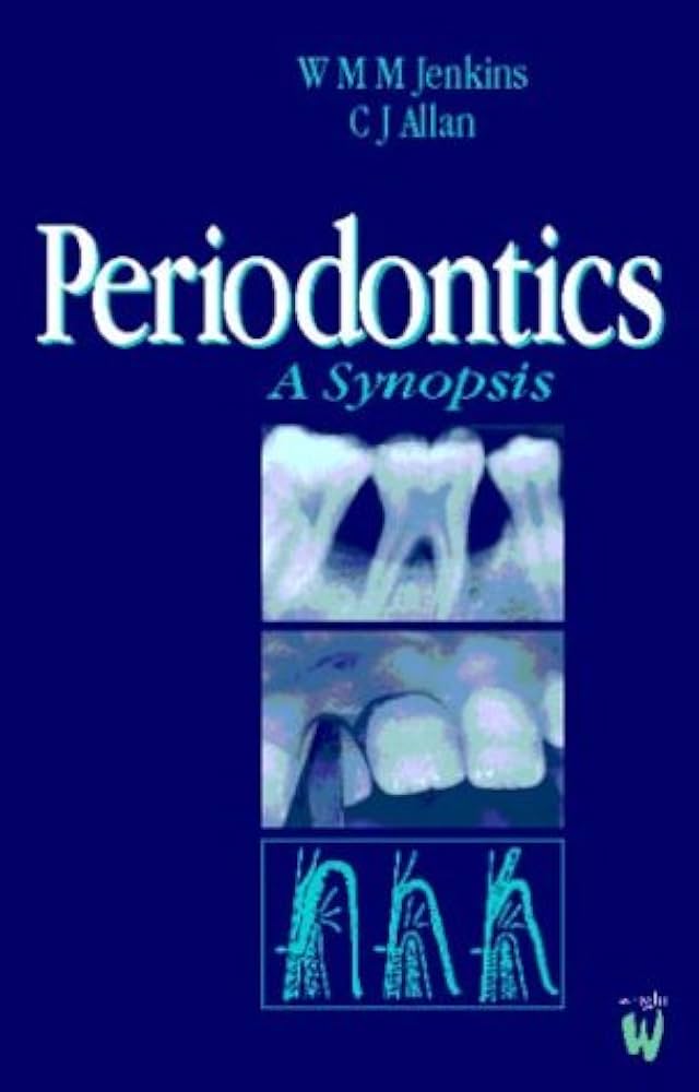 Periodontics: A Synopsis: 9780723610625: Medicine & Health Science