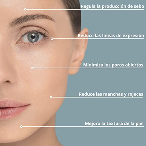 MIOXBEL Face Serum with Niacinamide 10% and Zinc 1%, 30 ml (Pack of 1) - Image 2