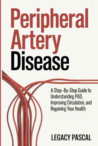 Peripheral Artery Disease: A Step-by-Step Guide to Understanding PAD, Improving