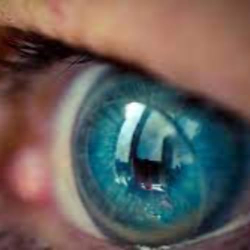 El lente de contacto sobre el ojo LEONEL SALMER&Oacute;N LEAL