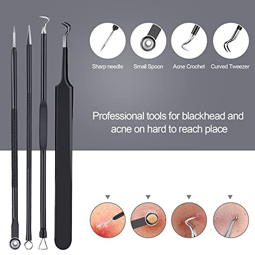 Pimple Popper Tool Kit 10 Pcs, Menoly Newest Blackhead Remover Pimple Comedone Extractor Tools For Easy And Fast Removal Of Blackheads, Pimples And Blemish On Face, With Elaborate Leather Bag #TOP2