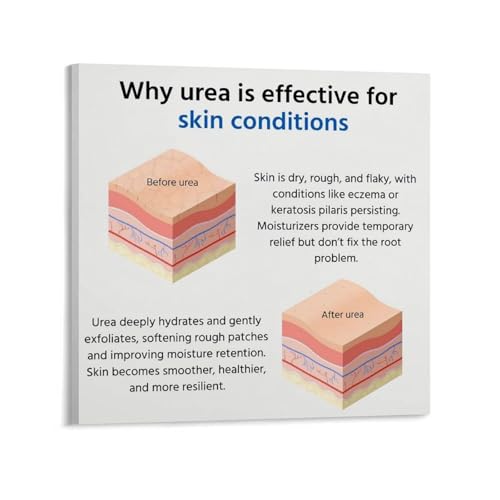 How Urea Is Effective for Skin Conditions Poster Eczema Keratosis