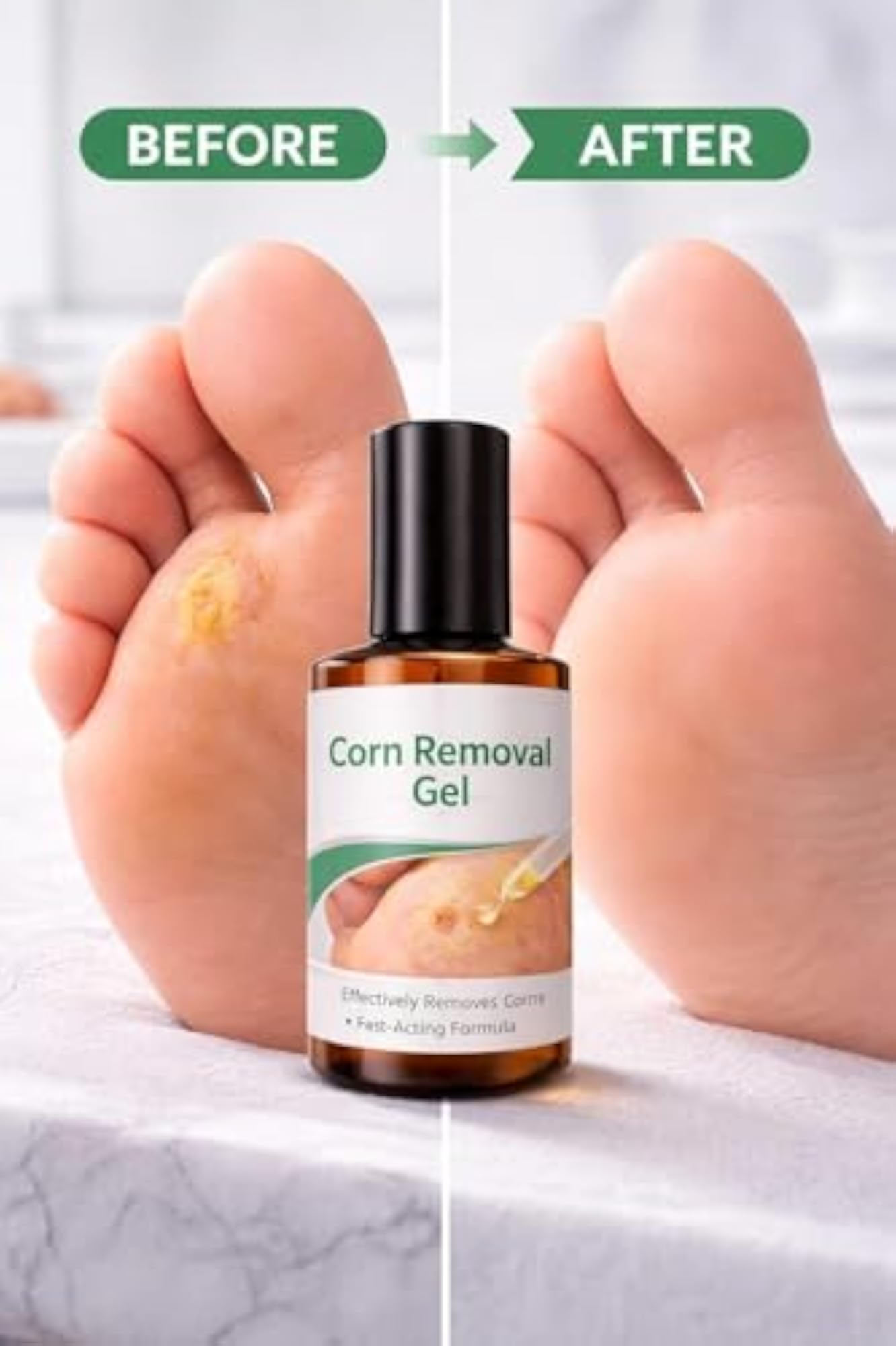 Fast Acting Corn Removal Gel for Feet, Callus Softener
