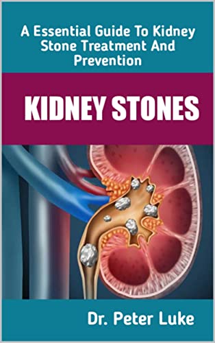 KIDNEY STONES: An Essential Guide To Kidney Stone Treatment and Prevention KIDNEY STONES: An Essential Guide To Kidney Stone Treatment and Prevention