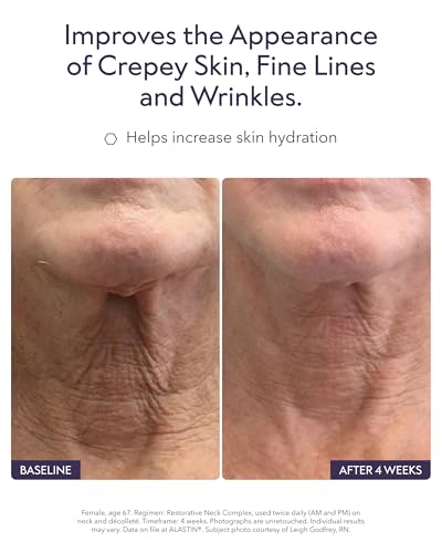 Image of ALASTIN Skincare Restorative Neck Complex Firming Cream (1.7 oz)