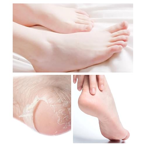 4 Paar Fußmaske - Hornhaut Socken, Fussmaske für Fußpflege, Hornhautentferner Socken, Extreme Hornhaut Entfernen Fußpeeling Mask, Fusspflege Anti Hornhaut Socken für Weihnachtsgeschenke (Pfirsich)