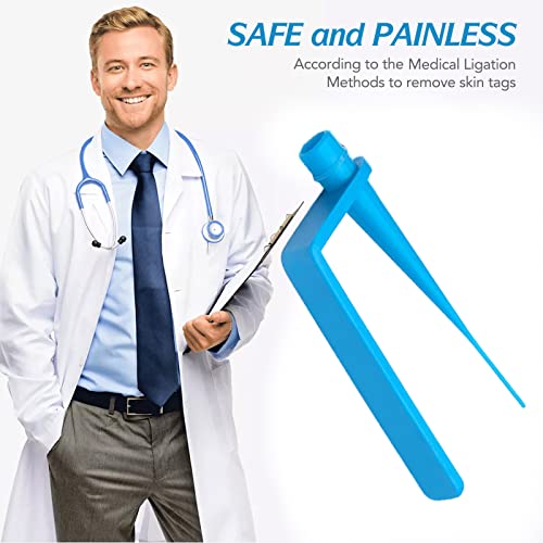 Image of Skin Tag Remover Kit (2-4mm) CONR Micro Painless DIY at Home with Cleansing Swabs Non Toxic Face Care Mole Wart Tool For Small To Medium Skin Tag (not for smaller than 2mm or flat skin tags)