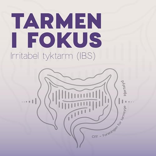Couverture de Tarmen i fokus - Irritabel tyktarm