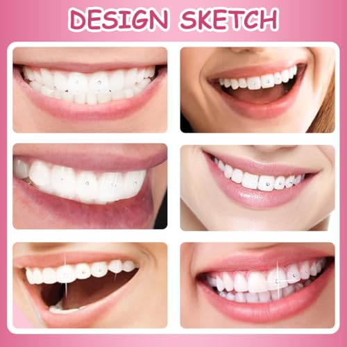 YUPZAR 1 Satz DIY Tooth gem kit DIY Mit Kleber zahnsteine selber kleben set, für Reflektierende Zahnverzierungs-Dekoration