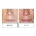 Replenix Age Restore Brightening Face Moisturizer with Hyaluronic Acid, Niacinamide & Ceramides, Medical-Grade Oil-Free Facial Cream for Mature Skin (1.7 oz)