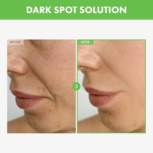 TOSOWOONG Kakadu Plum Blemish Cream 600.000 ppm Kakadu-Pflaume & Vitamin C, Niacinamid & Adenosin, 50g für Pigmentflecke