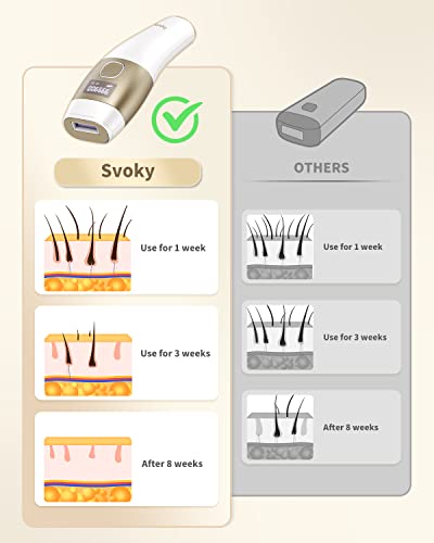 Svoky Ipl Laser Hair Removal Device For Women And Men Permanent With Painless Ice Cooling Function, At Home Handset Laser Hair Removal For Armpits Legs Bikini Line, Rated At 999,900 Flashes, Cord #TOP5