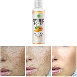 Toner for Dark Spots Turmeric Dark Spot Corrector Toner, Facial Toner for Acne Prone Skin, Dark Spot Remover for Face Hydrating Face Toner for Women, Hyperpigmentation Treatment for Dry Oily Skin 4OZ